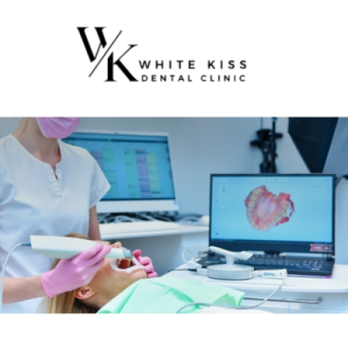 WhiteKiss – clinica stomatologică în care zâmbetul începe cu încrederea