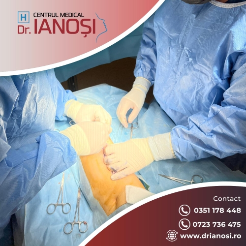 Tratament complet și complex al varicelor img.0