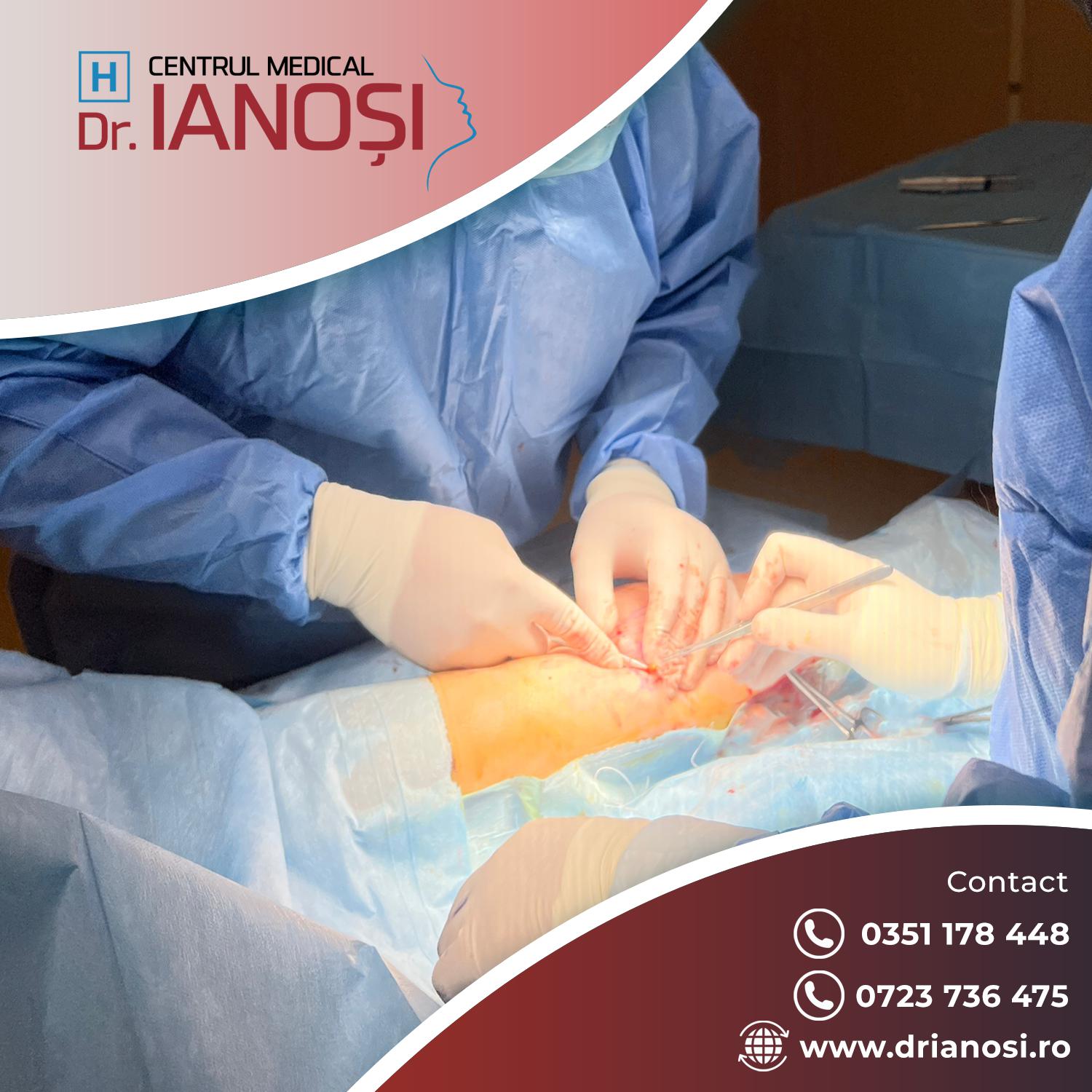 Tratament complet și complex al varicelor img.3