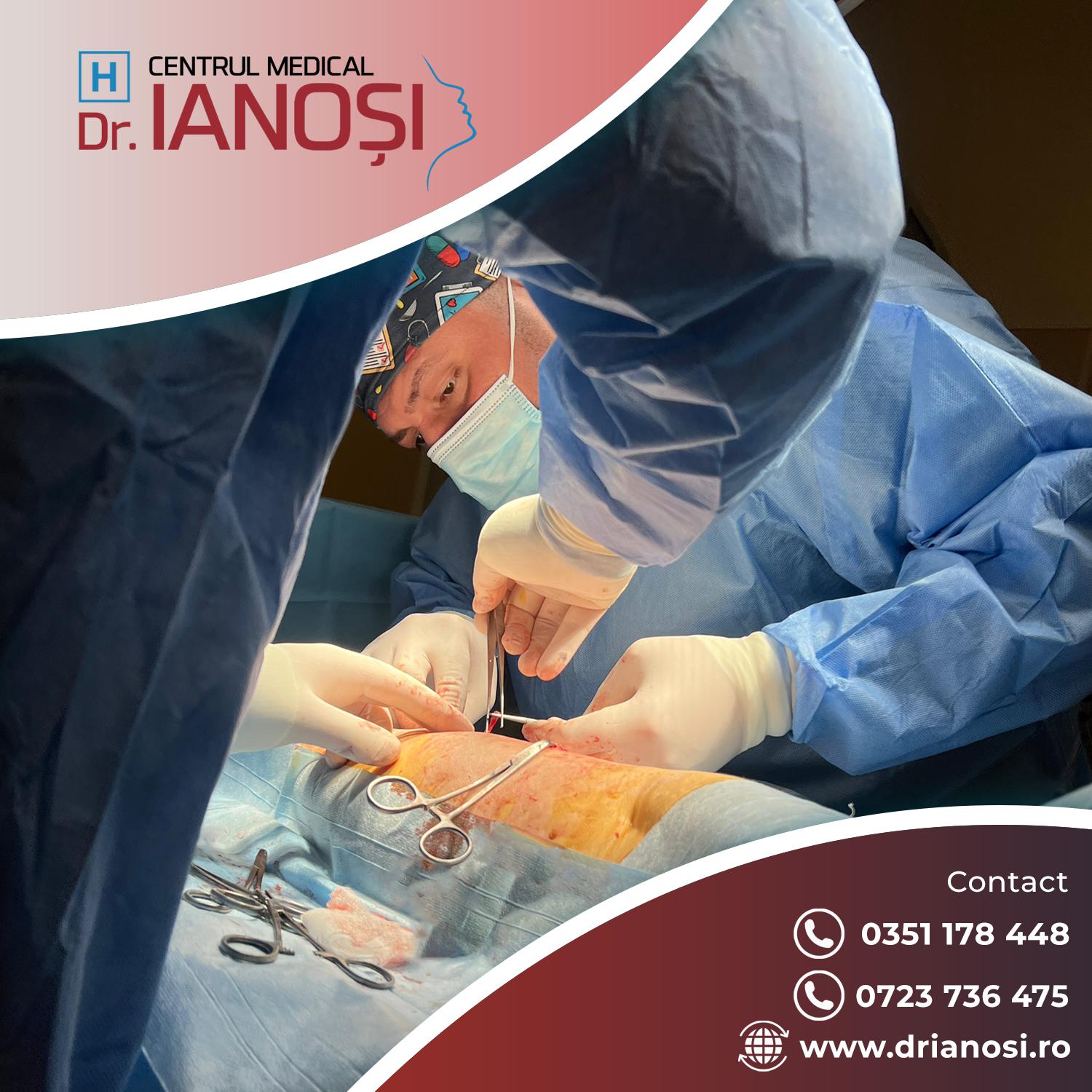 Tratament complet și complex al varicelor img.2